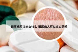 银屑病可以吃山竹么 银屑病人可以吃山药吗