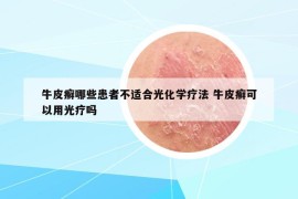 牛皮癣哪些患者不适合光化学疗法 牛皮癣可以用光疗吗