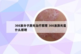 308准分子激光治疗原理 308准激光是什么原理