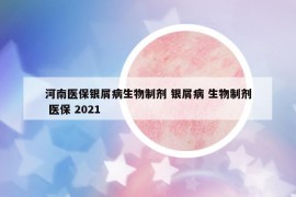 河南医保银屑病生物制剂 银屑病 生物制剂 医保 2021