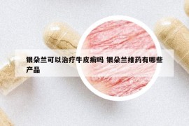 银朵兰可以治疗牛皮癣吗 银朵兰维药有哪些产品