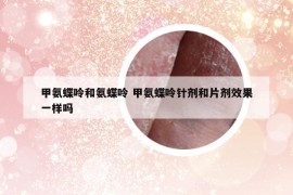 甲氨蝶呤和氨蝶呤 甲氨蝶呤针剂和片剂效果一样吗