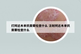 打阿达木单抗需要检查什么 注射阿达木单抗需要检查什么