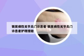 银屑病性关节炎门诊患者 银屑病性关节炎门诊患者护理措施