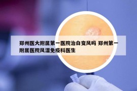 郑州医大附属第一医院治白变风吗 郑州第一附属医院风湿免疫科医生