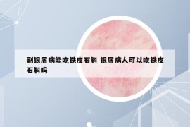 副银屑病能吃铁皮石斛 银屑病人可以吃铁皮石斛吗