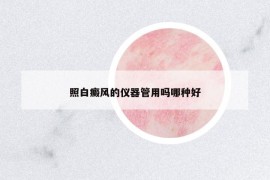 照白癜风的仪器管用吗哪种好
