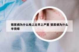 银屑病为什么晚上比早上严重 银屑病为什么半夜痒