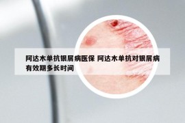 阿达木单抗银屑病医保 阿达木单抗对银屑病有效期多长时间