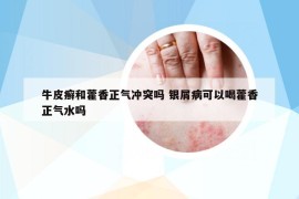牛皮癣和藿香正气冲突吗 银屑病可以喝藿香正气水吗