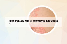 中信皮肤科医院地址 中信皮肤科治疗可靠吗?