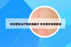 单克隆体治疗银屑病最好 单克隆抗体银屑病