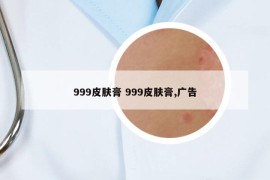 999皮肤膏 999皮肤膏,广告