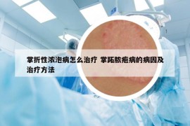 掌折性浓泡病怎么治疗 掌跖脓疱病的病因及治疗方法