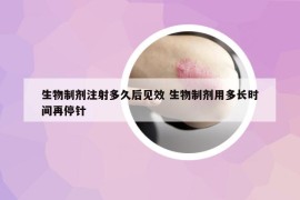 生物制剂注射多久后见效 生物制剂用多长时间再停针