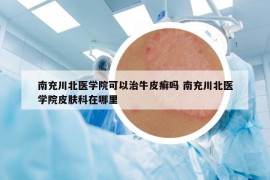 南充川北医学院可以治牛皮癣吗 南充川北医学院皮肤科在哪里