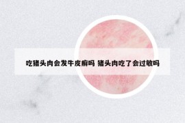 吃猪头肉会发牛皮癣吗 猪头肉吃了会过敏吗