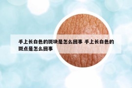 手上长白色的斑块是怎么回事 手上长白色的斑点是怎么回事