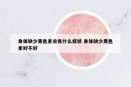 身体缺少黑色素会有什么症状 身体缺少黑色素好不好