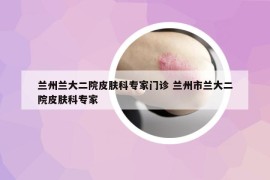 兰州兰大二院皮肤科专家门诊 兰州市兰大二院皮肤科专家