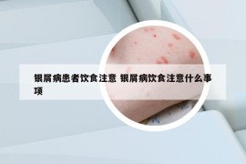 银屑病患者饮食注意 银屑病饮食注意什么事项
