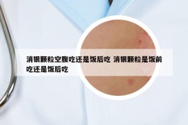 消银颗粒空腹吃还是饭后吃 消银颗粒是饭前吃还是饭后吃
