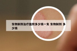 生物制剂治疗医院多少钱一支 生物制剂 多少钱