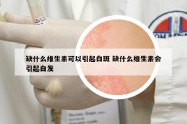 缺什么维生素可以引起白斑 缺什么维生素会引起白发