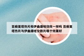 百癣夏塔热片和伊曲康唑功效一样吗 百癣夏塔热片与伊曲康唑分散片哪个效果好