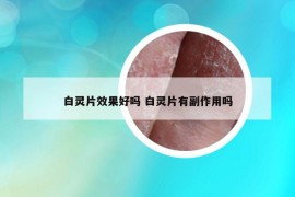 白灵片效果好吗 白灵片有副作用吗