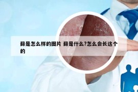 藓是怎么样的图片 藓是什么?怎么会长这个的