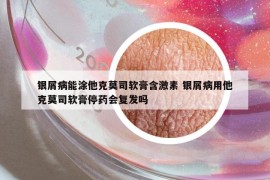 银屑病能涂他克莫司软膏含激素 银屑病用他克莫司软膏停药会复发吗