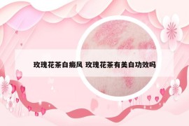 玫瑰花茶白癜风 玫瑰花茶有美白功效吗