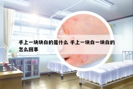 手上一块块白的是什么 手上一块白一块白的怎么回事