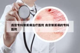 南京专科银屑病治疗医院 南京银屑病的专科医院