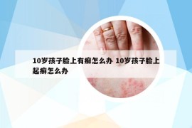 10岁孩子脸上有癣怎么办 10岁孩子脸上起癣怎么办
