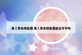 象喆草本焕能霜 象喆草本焕能霜能冶节节吗