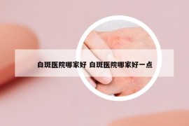 白斑医院哪家好 白斑医院哪家好一点