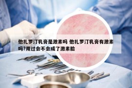 他扎罗汀乳膏是激素吗 他扎罗汀乳膏有激素吗?用过会不会成了激素脸