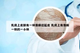 乳房上皮肤有一块像癣还起皮 乳房上有像癣一样的一小块
