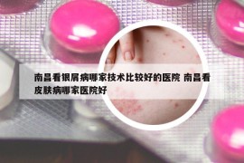 南昌看银屑病哪家技术比较好的医院 南昌看皮肤病哪家医院好