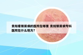 贵阳看银屑病的医院在哪里 贵阳银屑病专科医院在什么地方?