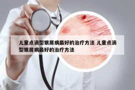 儿童点滴型银屑病最好的治疗方法 儿童点滴型银屑病最好的治疗方法