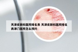 天津皮肤科医院排名表 天津皮肤科医院排名表津门医院怎么预约