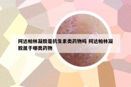 阿达帕林凝胶是抗生素类药物吗 阿达帕林凝胶属于哪类药物