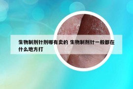 生物制剂针剂哪有卖的 生物制剂针一般都在什么地方打