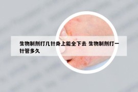 生物制剂打几针身上能全下去 生物制剂打一针管多久