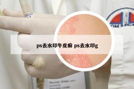 ps去水印牛皮癣 ps去水印g