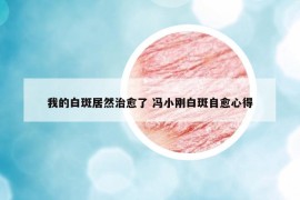 我的白斑居然治愈了 冯小刚白斑自愈心得