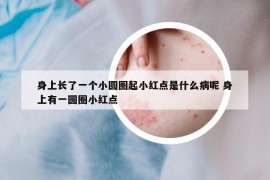 身上长了一个小圆圈起小红点是什么病呢 身上有一圆圈小红点